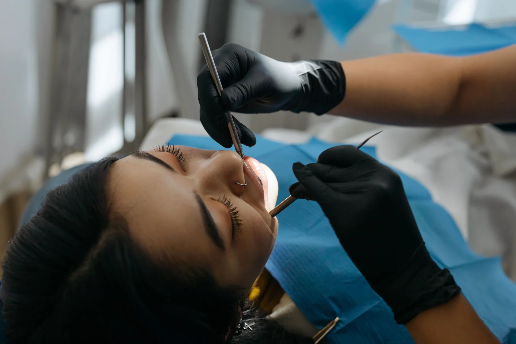 Dental Implants