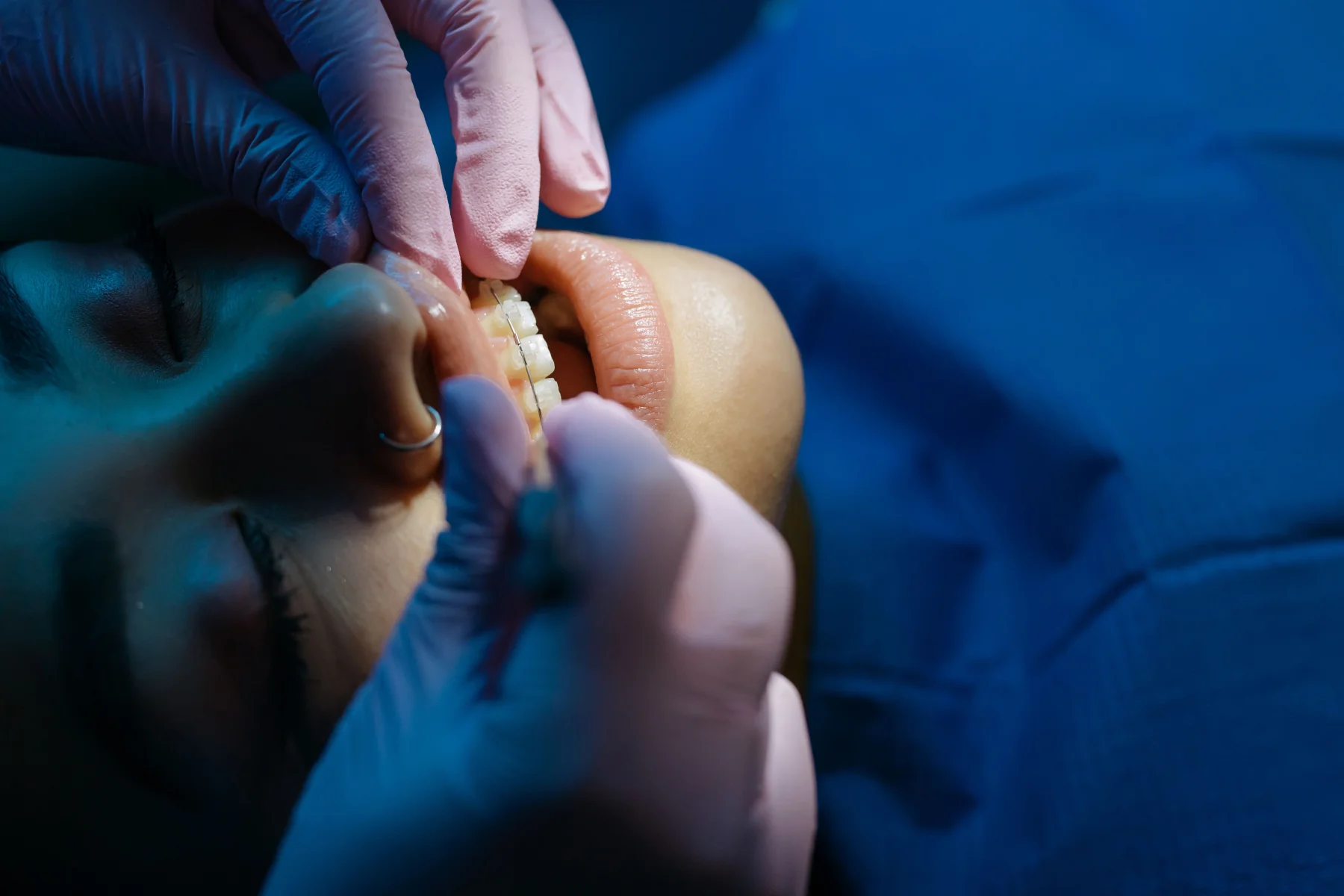 Pediatric Dentistry