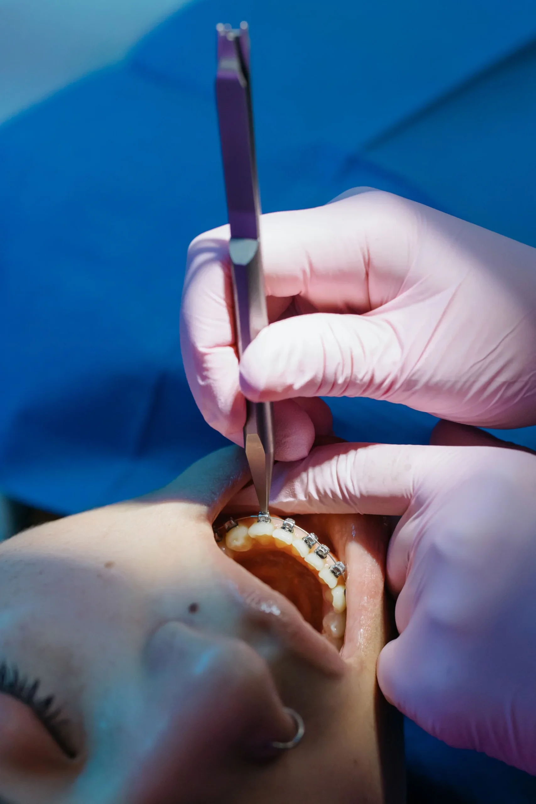 Pediatric Dentistry