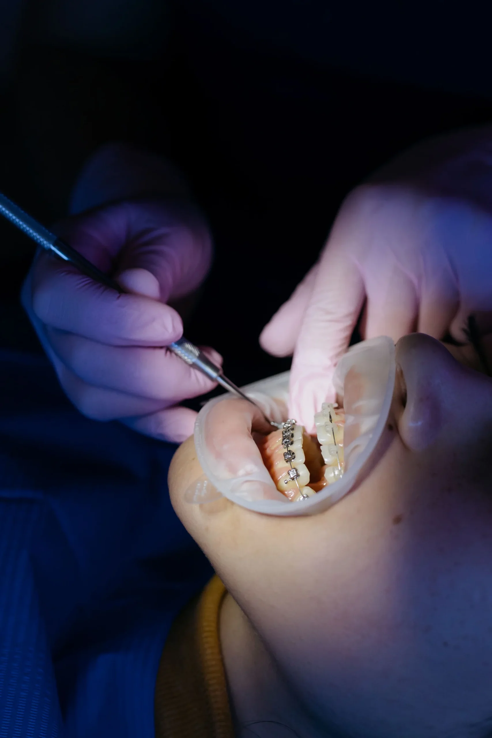 Pediatric Dentistry