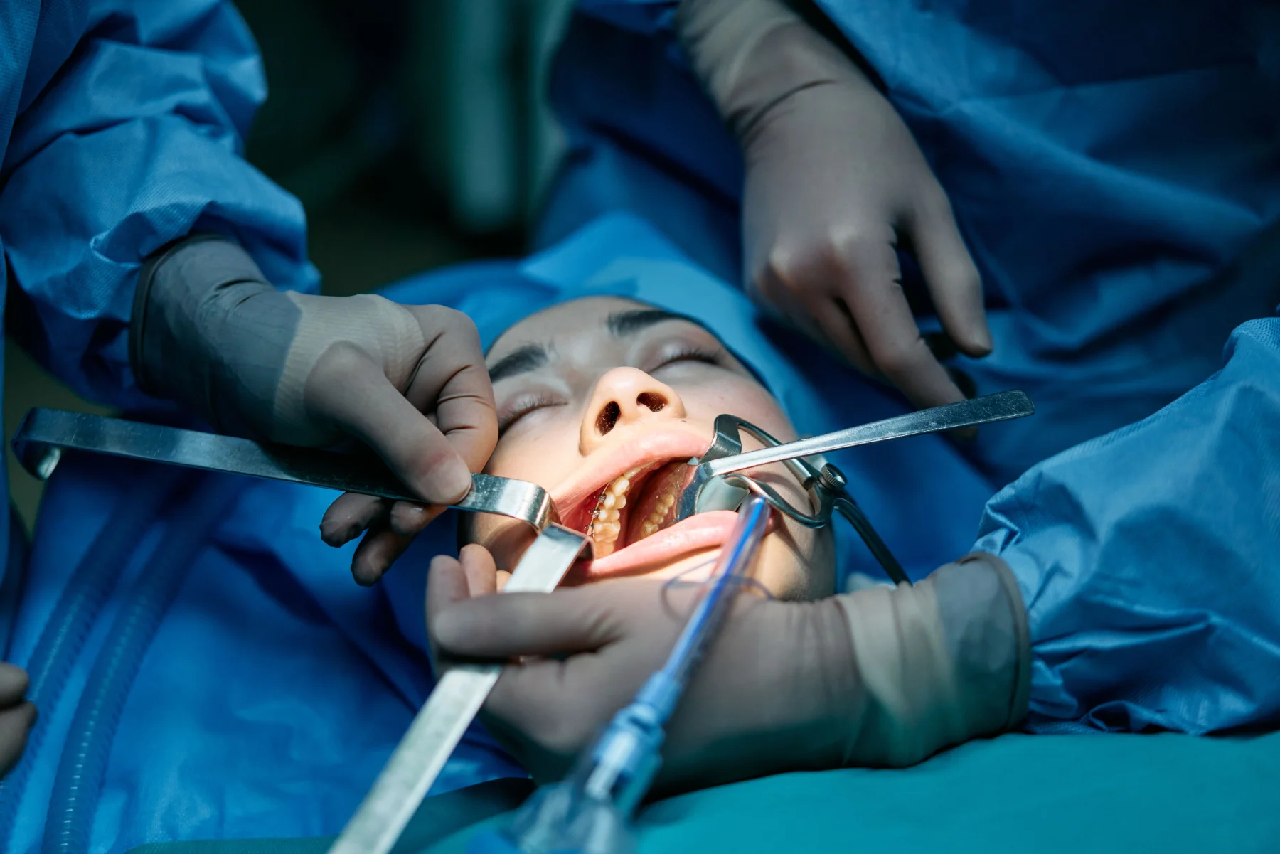 Dental Article