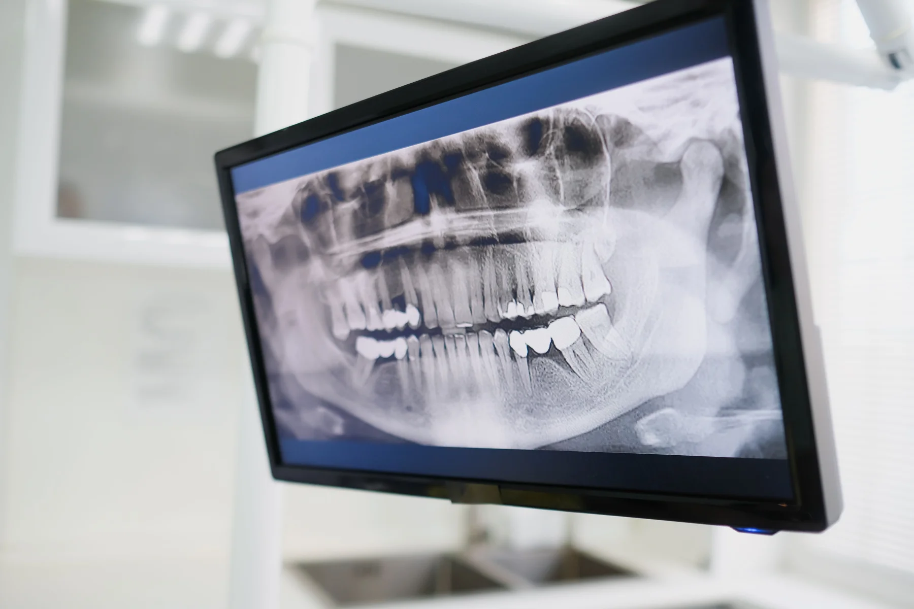 Emergency Dental