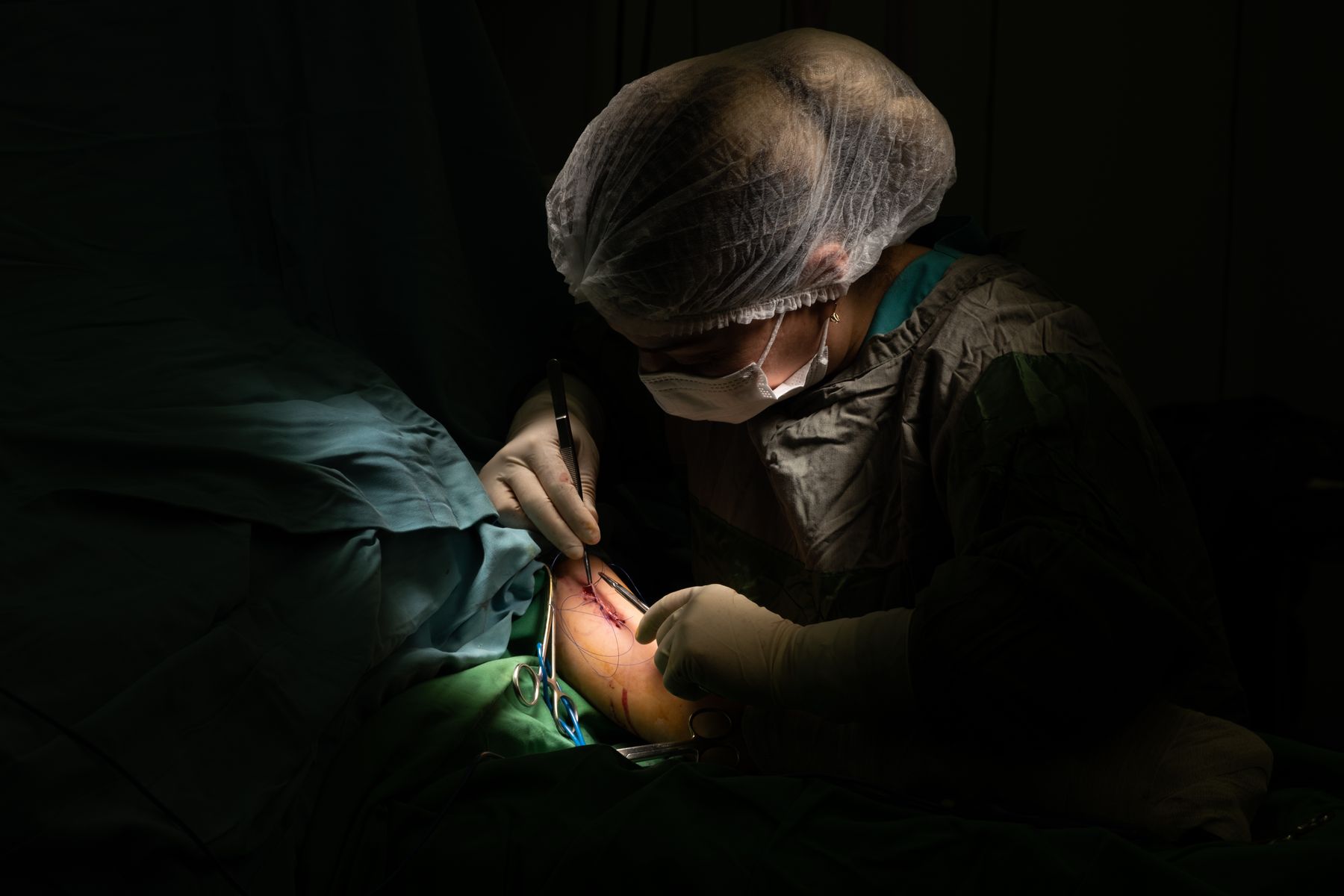 Nexolume Medical